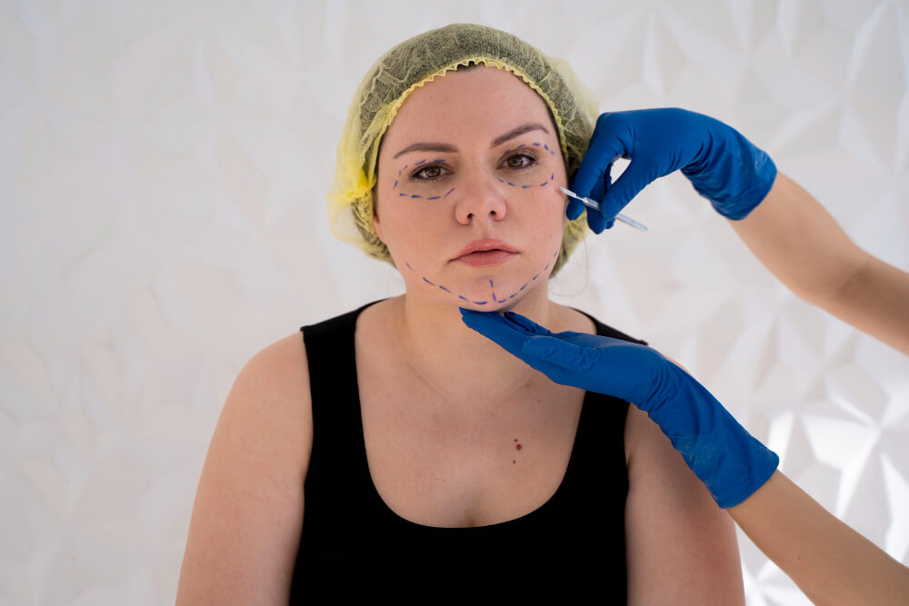 Juvederm Papada Antes y Después: Maestría en el rejuvenecimiento de la papada