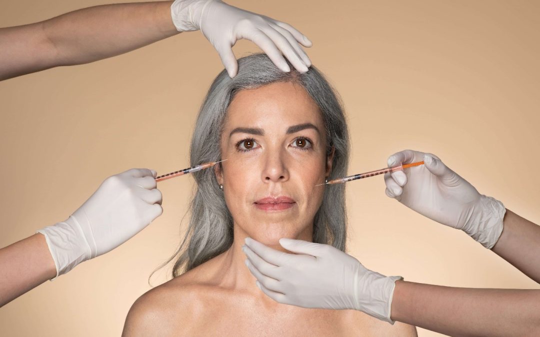 Suavizar los pliegues faciales con Profhilo para las líneas de marioneta