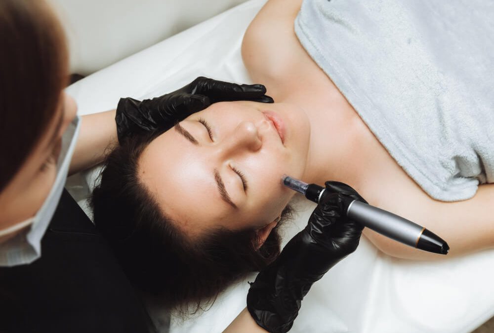 profhilo microneedling