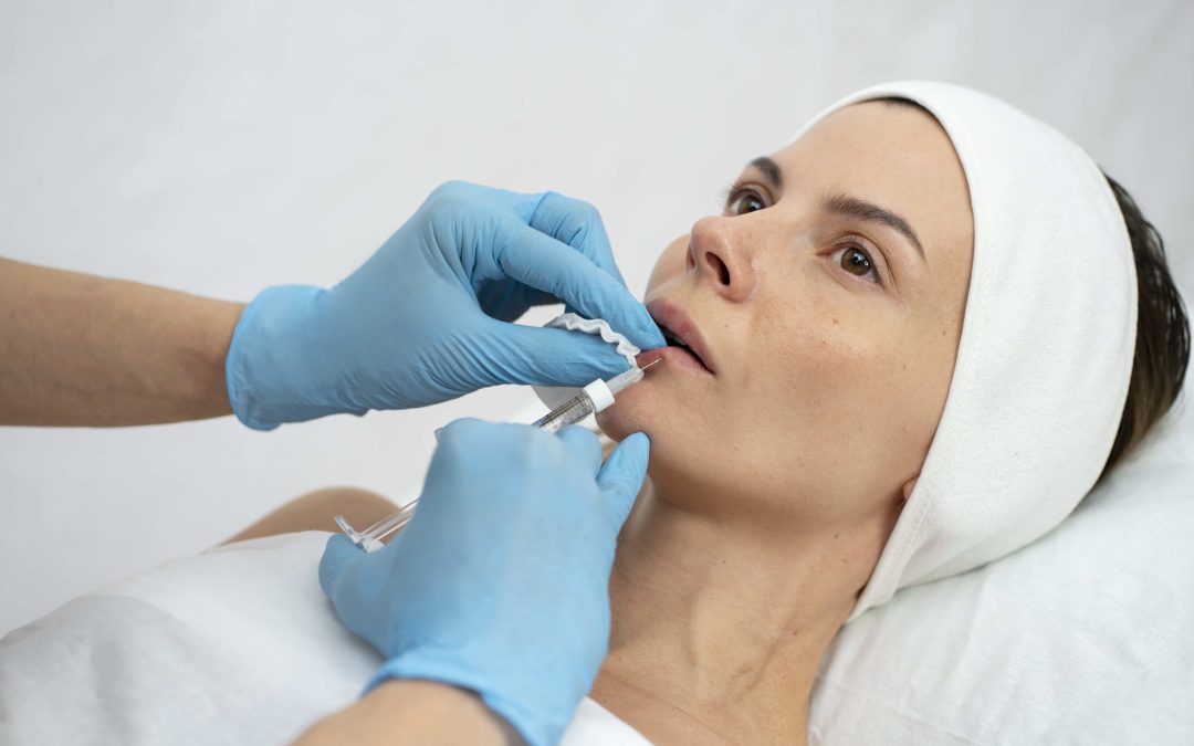 Profhilo Pliegues Nasolabiales: Perfeccionar la simetría facial
